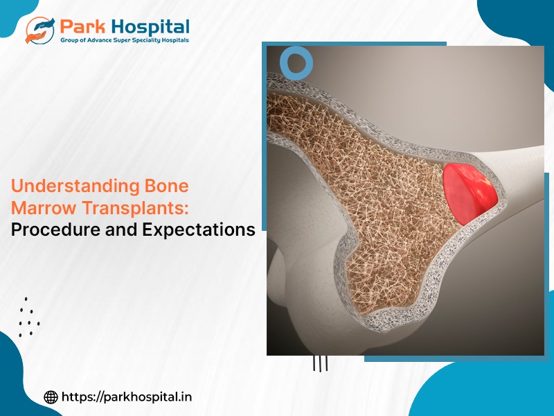 Understanding Bone Marrow Transplants: Procedure and Expectations